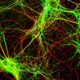 Weak magnetic fields were shown to influence brainwave patterns in humans, according to new research. Pictured here are neurons (green), which produce brain waves.